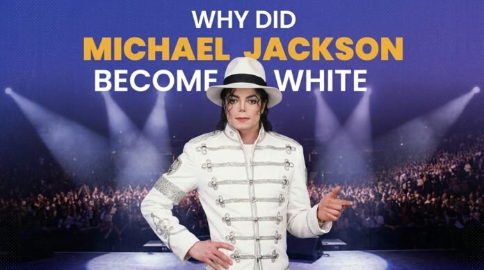 Why Did Michael Jackson Turn White